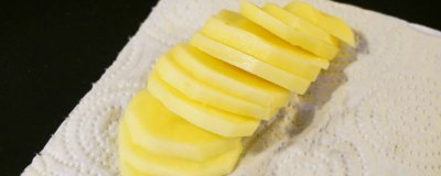 ​土豆能去黑眼圈吗