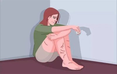 ​想自残怎么办怎么克制自己
