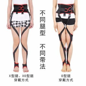 ​o型腿怎么矫正最有效(o型腿成年了还能矫正吗)