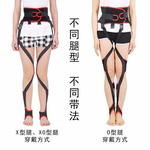 o型腿怎么矫正最有效(o型腿成年了还能矫正吗)-第1张图片-
