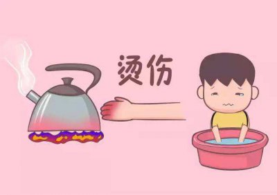 ​烫伤用什么方法好的最快 见效最快的十六种烫伤处理方法和4种误区