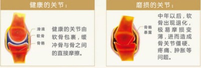 ​氨糖软骨素钙片的功效和作用 氨糖软骨素钙片的作用是什么？