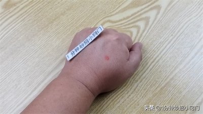 ​蚊子咬了怎么消肿止痒最快(被蚊子咬了又痒又难受，不用买药擦，教你一妙招，1
