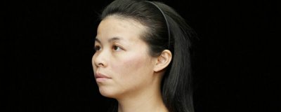 ​去除鼻唇沟的锻炼方法图片 去除鼻唇沟的锻炼方法图解