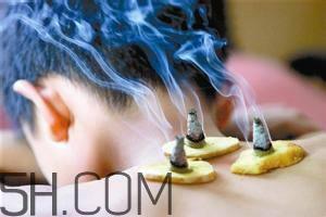 艾灸对慢性咽炎有用吗？慢性咽炎可以通过艾灸来治疗吗？