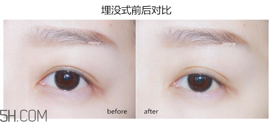 三种不同材质双眼皮贴的正确贴法图
