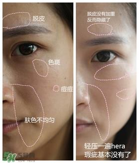 赫拉气垫用了闷痘吗？赫拉气垫闷痘怎么办？