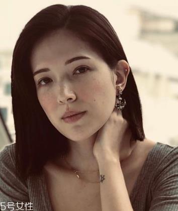 雀斑怎么去除效果好 医美去雀斑要注意保养