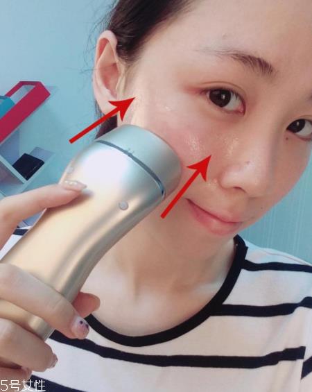 notime射频美容仪适合年龄 拯救熟龄肌衰老