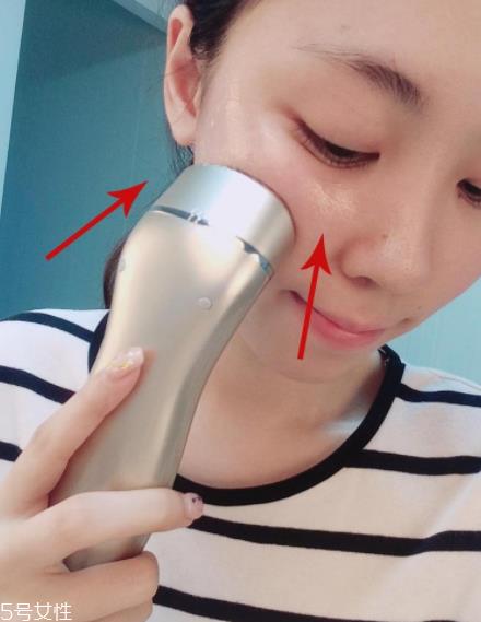 notime射频美容仪适合年龄 拯救熟龄肌衰老