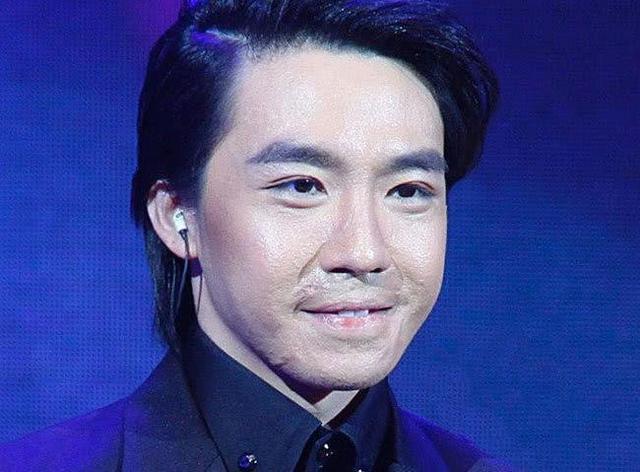 32岁俞灏明近照，因不堪舆论压力再次整容，颜值反转完胜小鲜肉