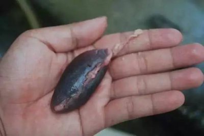 ​鱼胆有毒吗 鱼胆中毒的表现