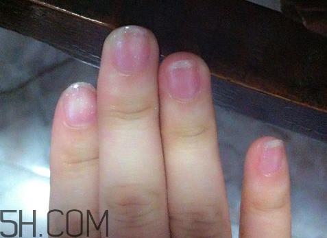 美甲后指甲受损怎么办？指甲破损怎么修复？