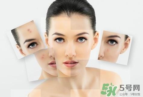 鼻子上长痘痘用什么药膏?鼻子上长痘痘涂什么药?