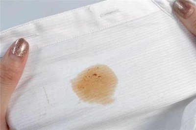 ​衣服上的蜡烛油怎么去除 采取局部加热