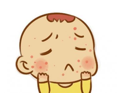 ​湿疹饮食要注意什么 湿疹不能吃什么