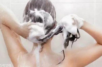 ​为什么洗完头隔天还痒 4个方面要注意