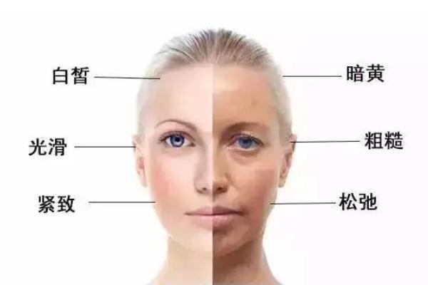 皮肤暗黄有痘印如何调理 皮肤暗黄有黑色素如何调理