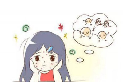 ​青春痘怎么快速消除 青春痘一般多久会消失