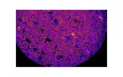 ​哪款减肥药好